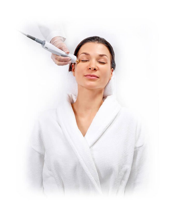 TempSure Treatment Process TempSure Treatment Process